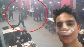 Antalya’da akran dehşeti! "Neden bakıyorsun" deyip burnunu kırdılar